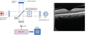 Figure 1a shows a basic OCT microscope layout, and 1b shows a retina scan done by OCT